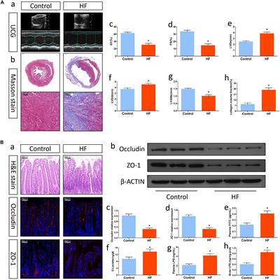 Intestinal Barrier Dysfunction Exacerbates Neuroinflammation via the TLR4 Pathway in Mice With Heart Failure